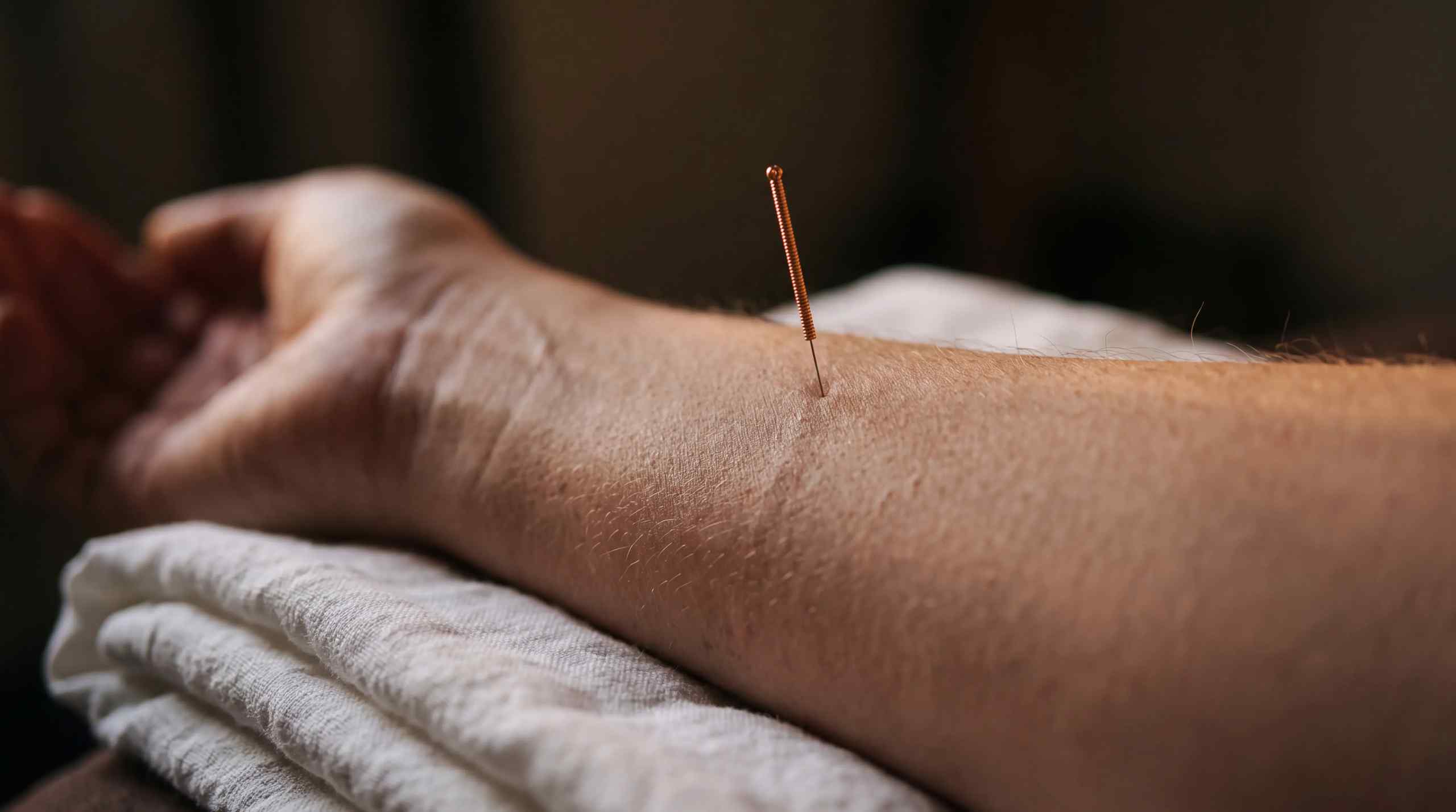 A person going through acupuncture.